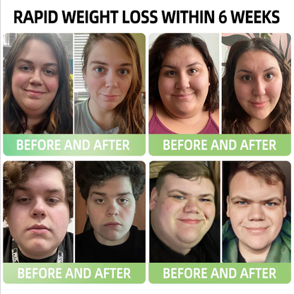 💫Cvreoz® Meglutide Diet & Health Boost Drops( 💫Food-grade fat burner – Developed by The Obesity Society) 💫